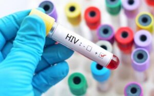 hiv-1783587379705637448126