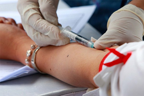 hiv2 16494133559261308354107